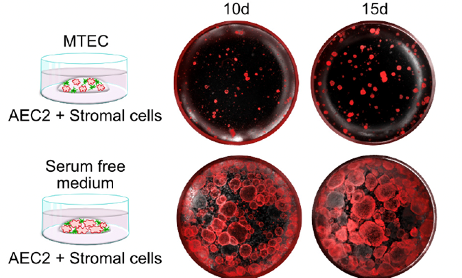 Serum- and stroma-free chemically defined system for lung stem cell expansion and differentiation