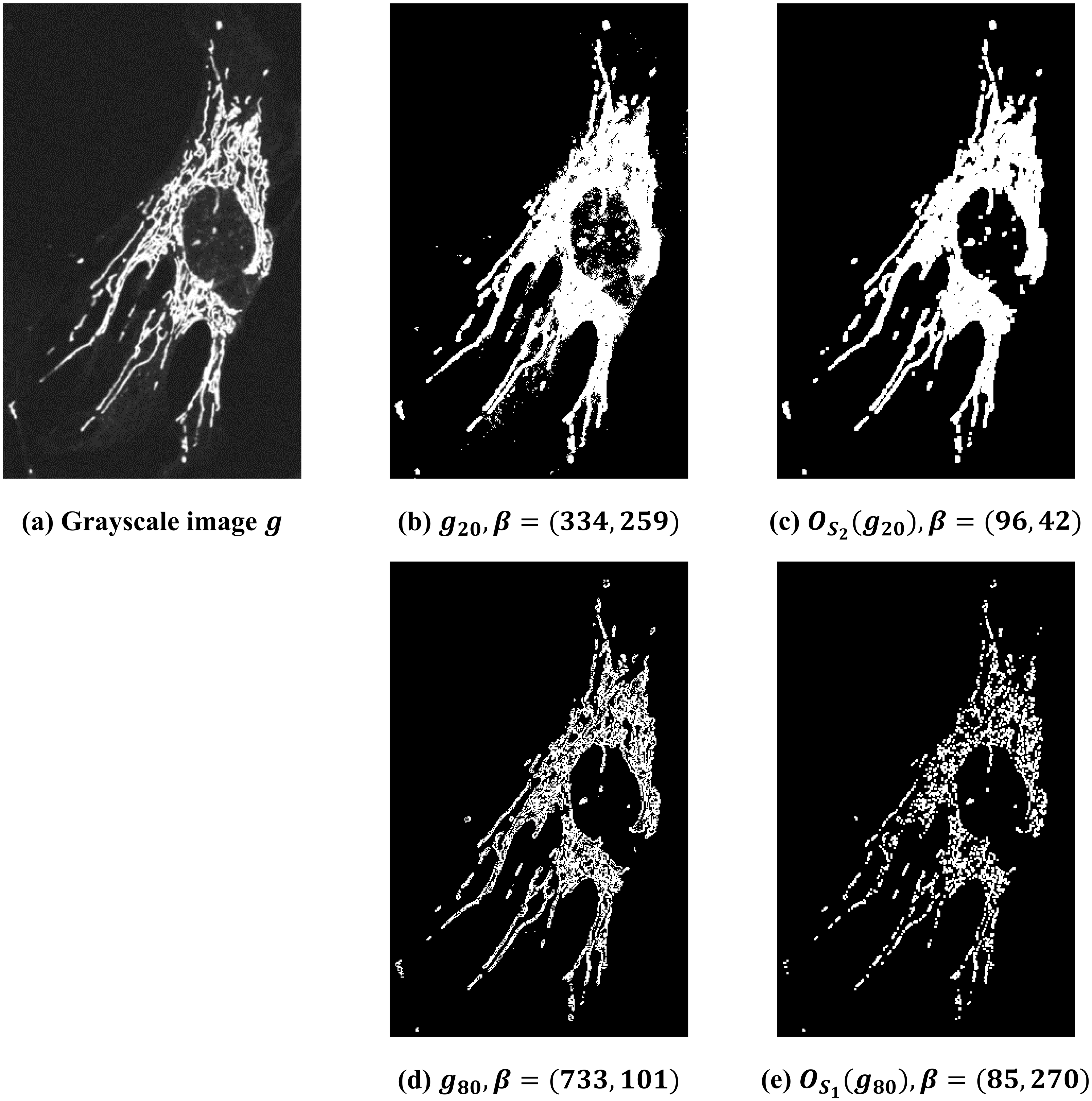 Morphological multiparameter filtration and persistent homology in mitochondrial image analysis