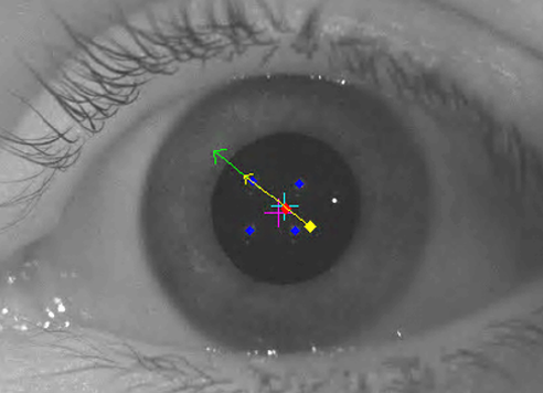 Auto-aligning handheld optical coherence tomography probe