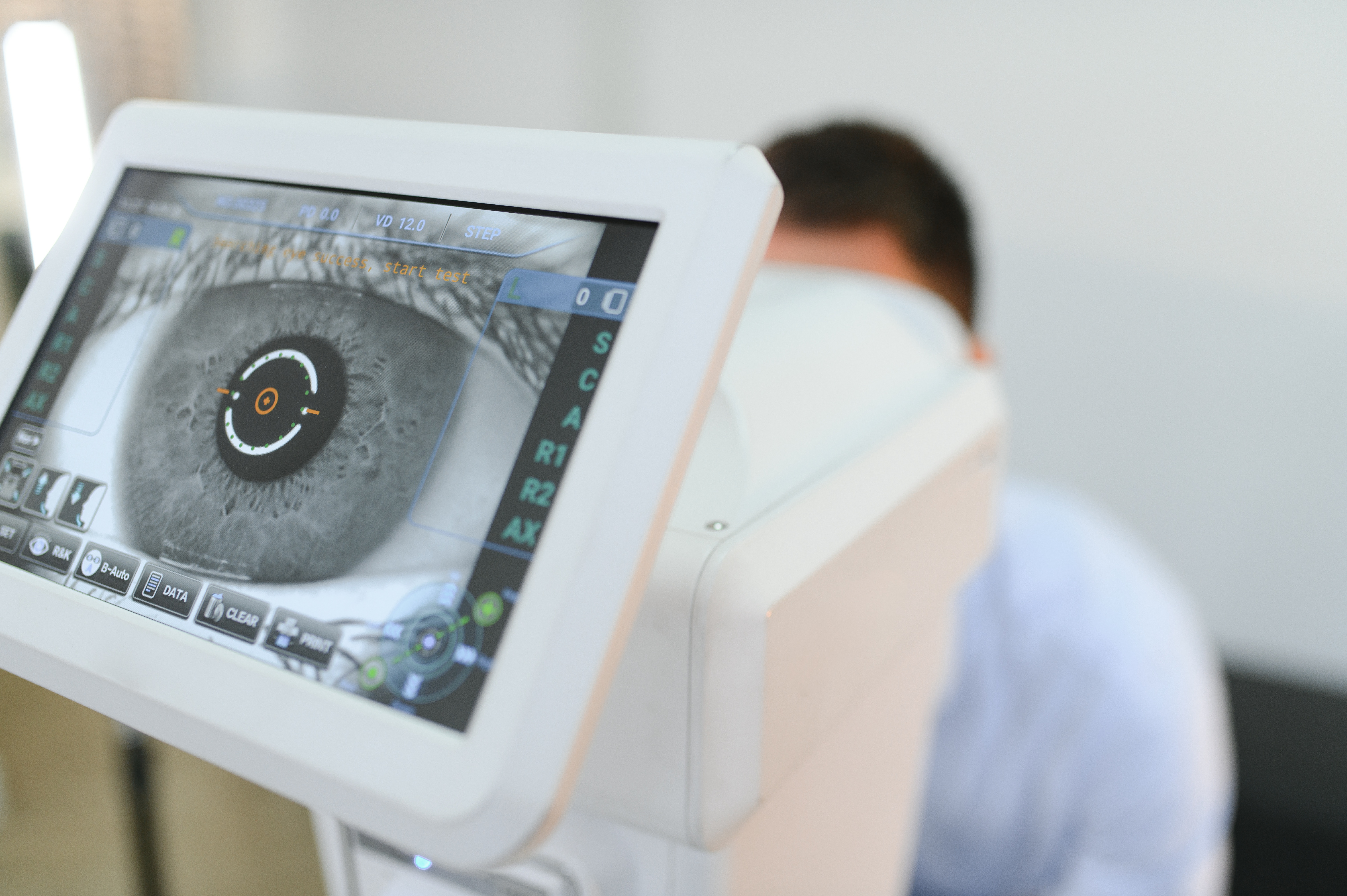 Non-invasive peripheral retinal scanner using OCT