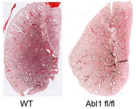 Abl kinase inhibitors promote lung regeneration after 