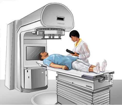 Doctor readies patient for external beam radiation, illustration. (NIH Medical Arts, National Cancer Institute)