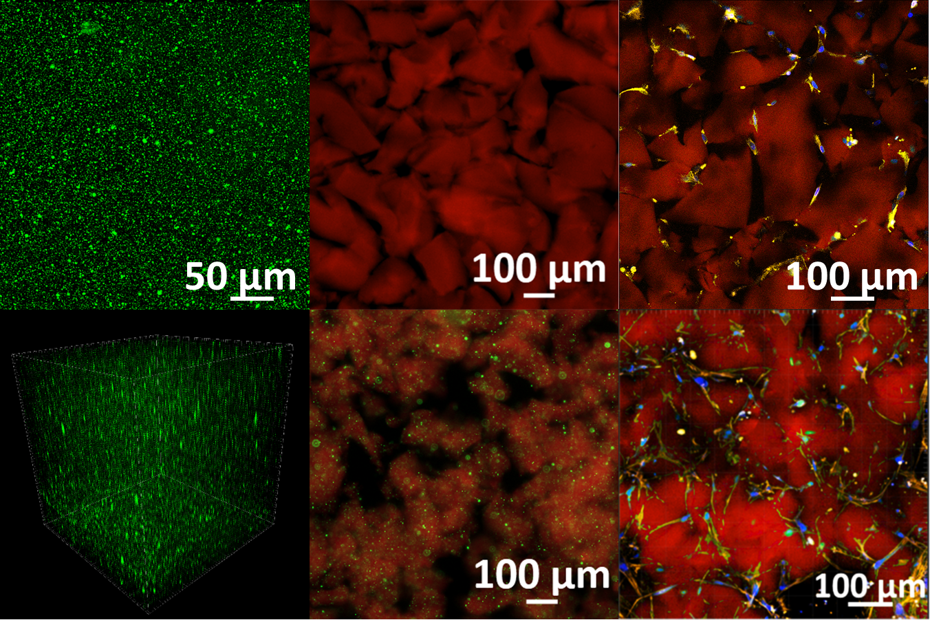 Stable particles present in the hydrogel material. Images provided by Dr. Tatiana Segura.