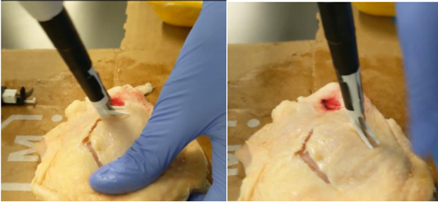 The dural cutting device demonstrated on chicken skin