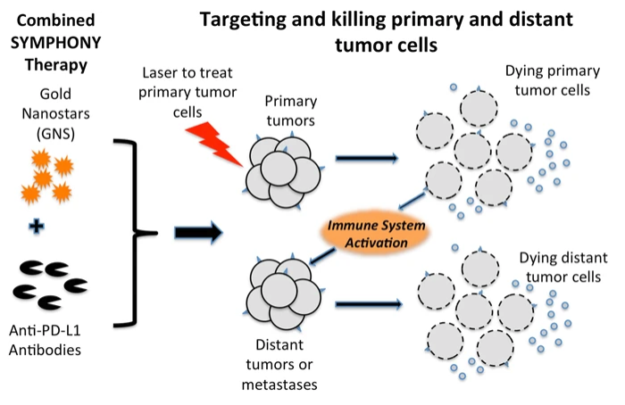 SYMPHONY: Synergistic Immuno Photothermal Nanotherapy. By disabling the tumor immune resistance using anti-PD-L1 antibodies and simultaneously ablating individual cancer cells using GNS-enabled photothermal therapy, SYMPHONY can trigger a powerful thermally enhanced systemic immune activation to rapidly eradicate locally aggressive as well as distant metastatic cancer. Figure 1 from Liu, Y., Maccarini, P., Palmer, G.M. et al. Synergistic Immuno Photothermal Nanotherapy (SYMPHONY) for the Treatment of Unresectable and Metastatic Cancers. Sci Rep 7, 8606 (2017). https://doi.org/10.1038/s41598-017-09116-1. To view copy of license:  http://creativecommons.org/licenses/by/4.0/.