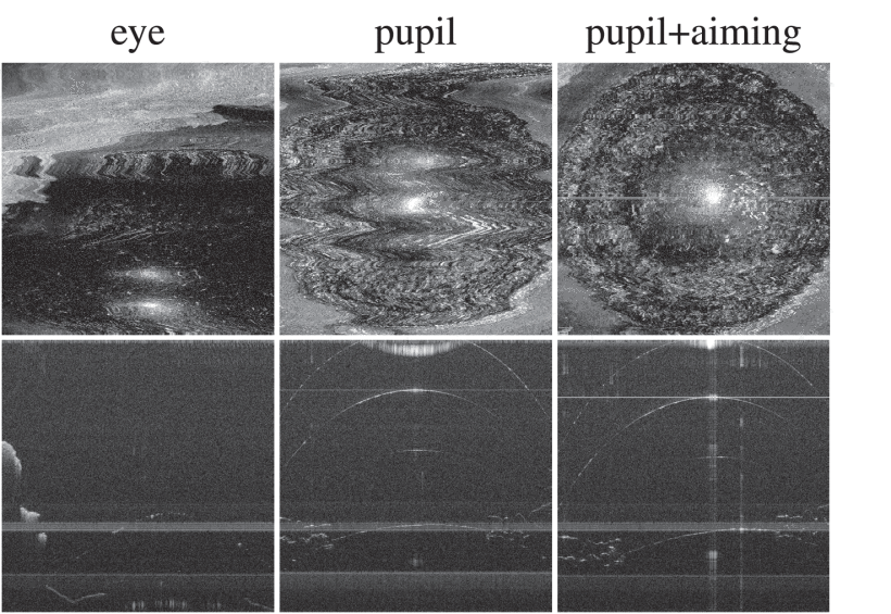 A comparison of tracking modes by collected OCT maximum intensity projections and B-scans. Eye tracking (left) and pupil tracking mode (center) both show unusable images, and this technology (right) shows a usable image. Figure 13 from PCT Application US2020/015598.