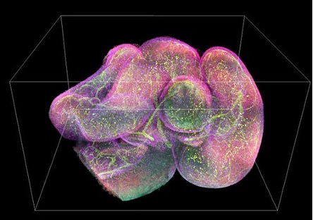 3D Image of a mouse intestine with different antibodies in green, red, yellow and purple. 