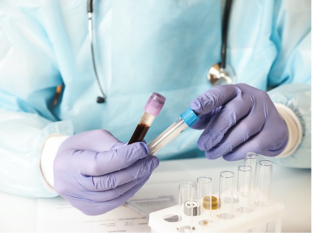Doctor holding biological samples in test tubes