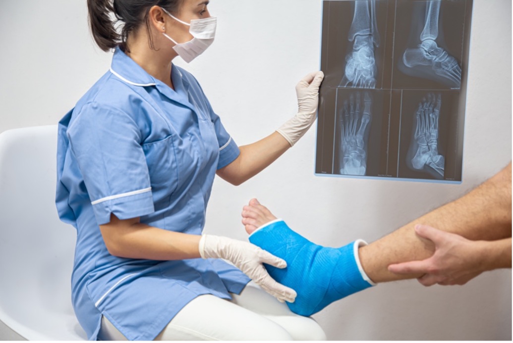 Doctor examining x-ray of patient with broken foot