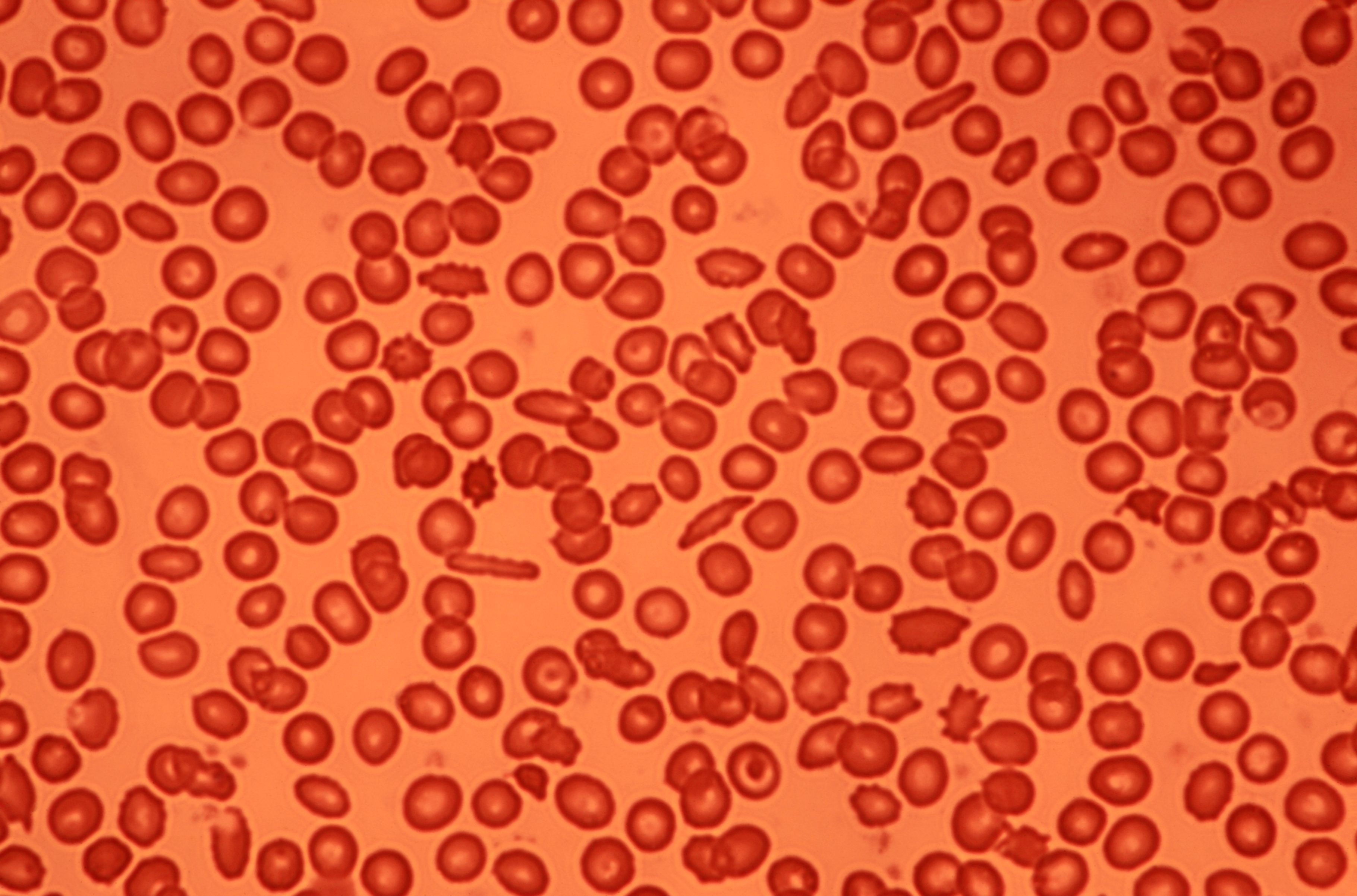 Microscope image of human blood cells.