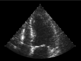 A high-speed echocardiographic system that can assess cardiac function in real-time