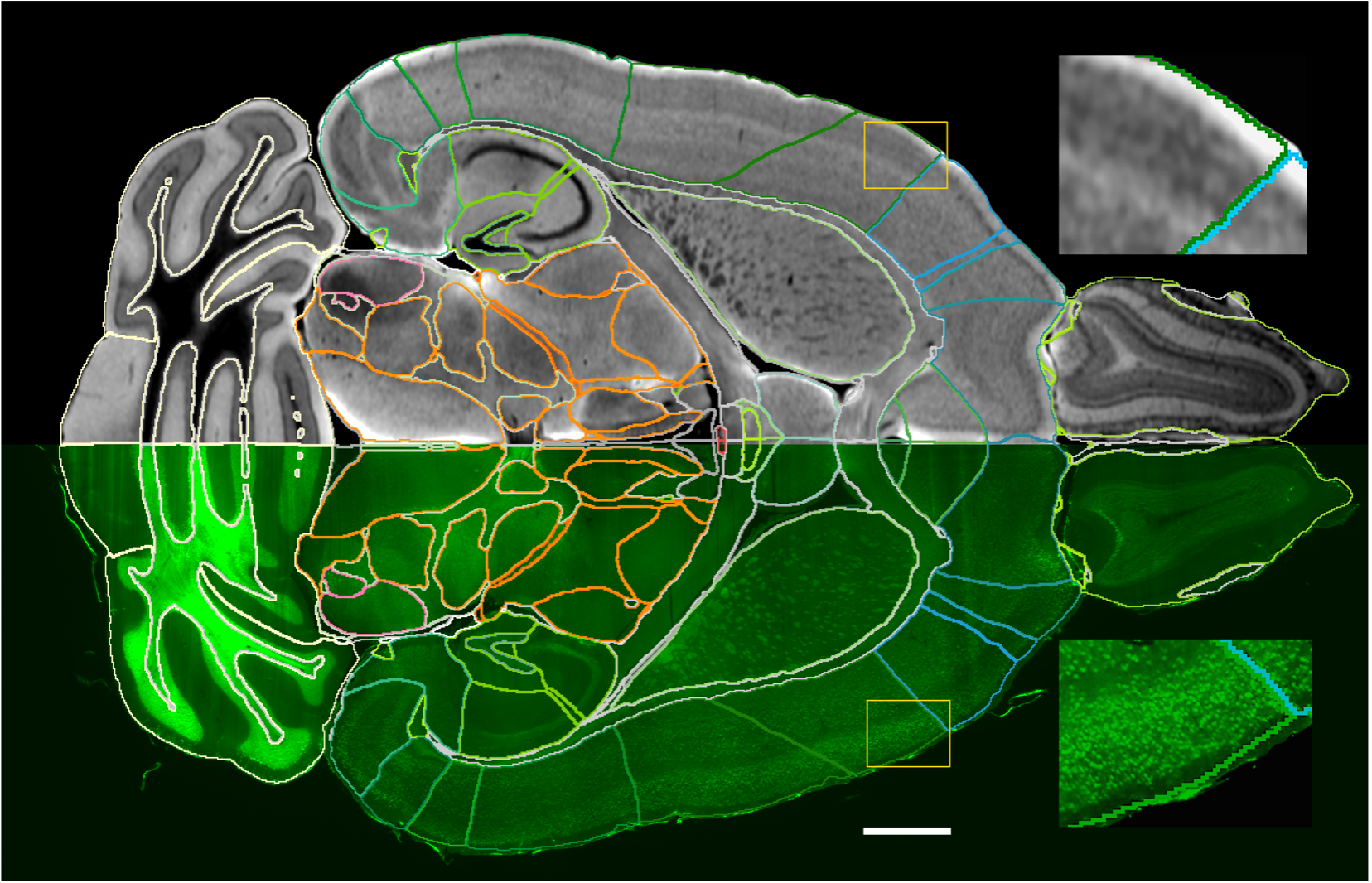 Image of technology mapping overlay over mouse brain (Source: CC via NeuroImage. https://www.sciencedirect.com/science/article/pii/S1053811921007436)