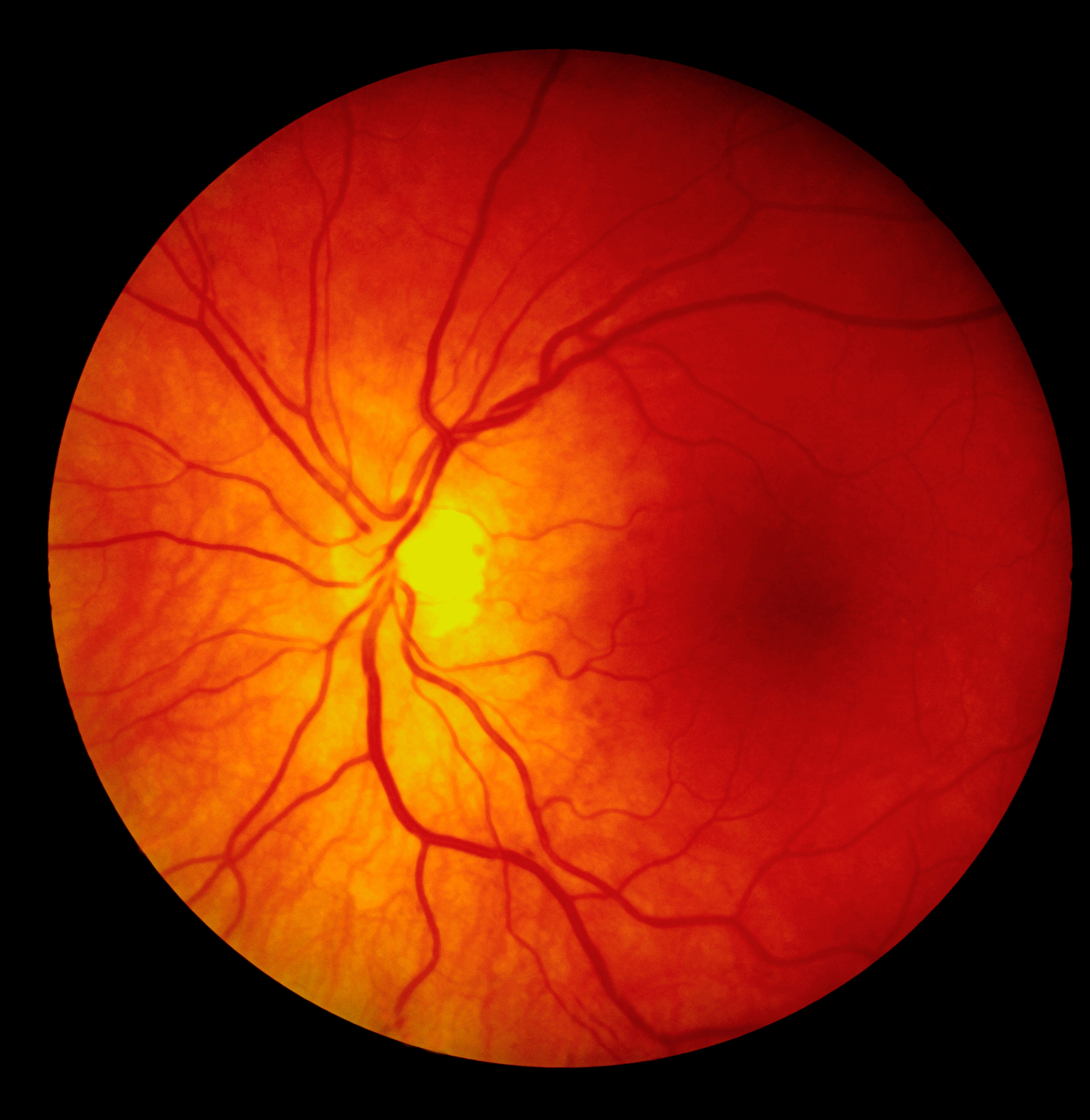 Image of retina (source: envato)