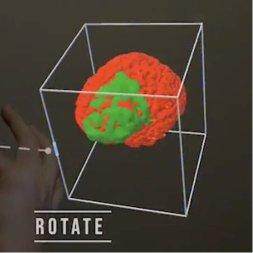 Augmented reality projection of brain scan in red, showing brain region of interest in green. Demonstrating the “rotate” hand gesture feature. (Source: inventors)